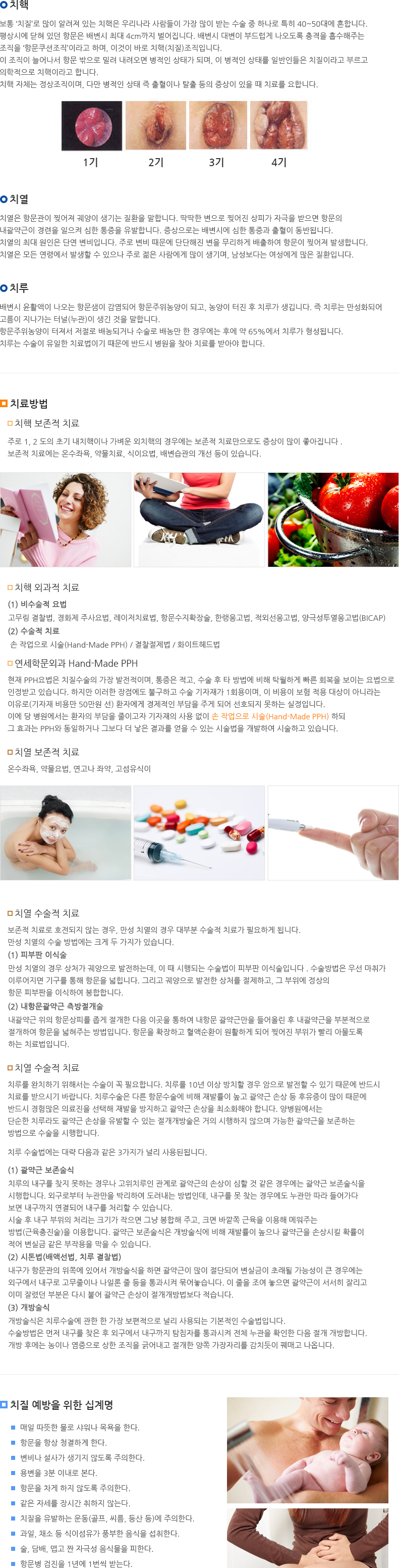 치핵·치열·치루