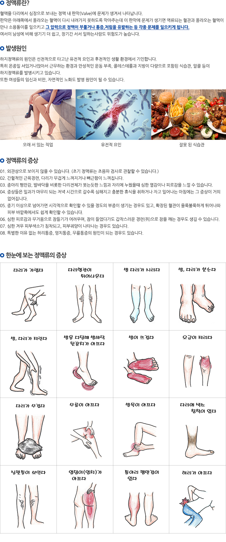 정맥류·망상정맥·모세혈관 확장증