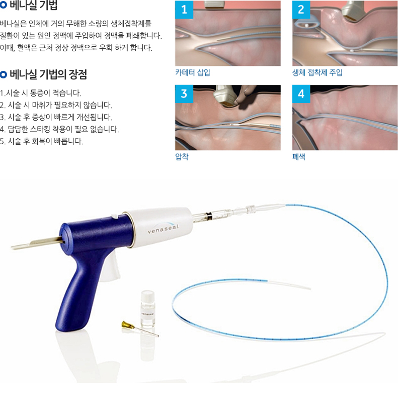 모세혈관 확장증